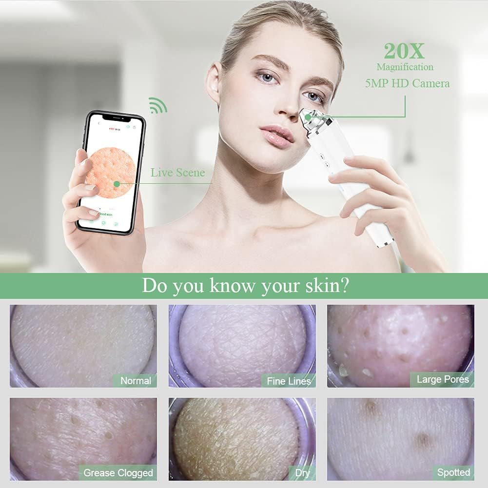 20X Magnification Electric Blackhead Remover with Camera - White Buy Your Favorites