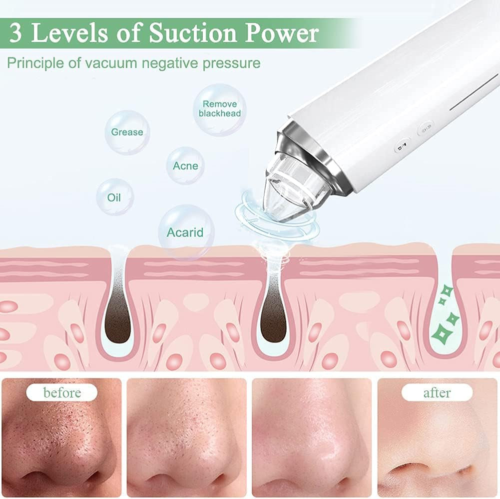 20X Magnification Electric Blackhead Remover with Camera - White Buy Your Favorites